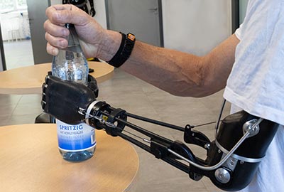 Eine Person mit einer Armprothese hält mit der Prothesenhand eine Wasserflasche fest, um sie mit der anderen Hand zu öffnen.